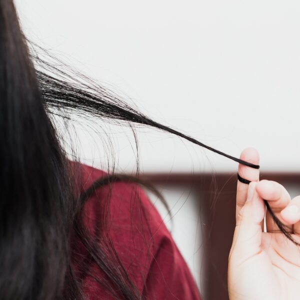 OCD and Hair Pulling: Understanding Causes, Treatments, and Coping Strategies
